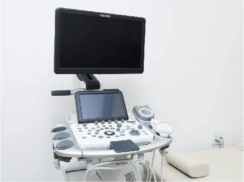 超音波診断装置