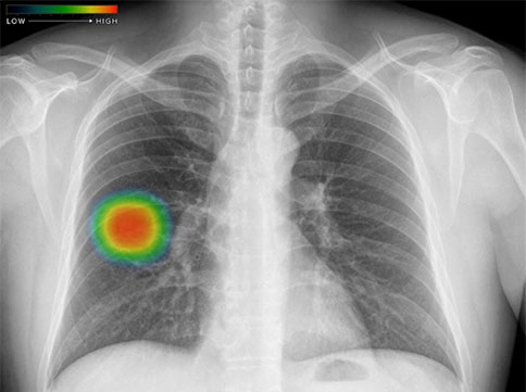 内視鏡システム