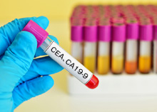 健康診断オプション検査内容