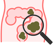 腹部レントゲン