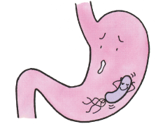 鼻から胃カメラ検査